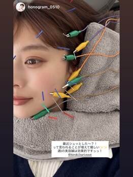 ニュート 表参道 外苑前(NUUT)/NUUT/ニュート/美容鍼/鍼灸/小顔