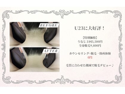 リアンの写真