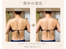 艶の雰囲気（お腹まわりを引き締め、すっきりラインへ）