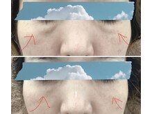 ザ ファーストサロン(The First Salon)/目元の悩み