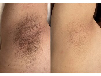 ニコ(nico)/わきモニター