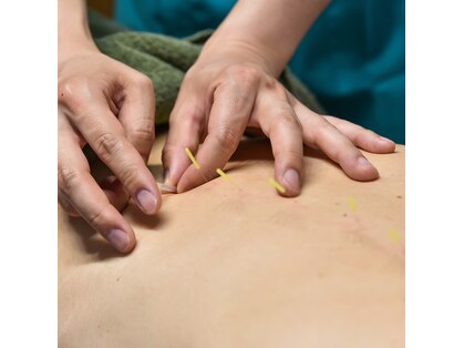 金町5丁目鍼灸マッサージ院の写真