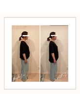 ソワン(soin)/【小顔矯正・整顔×エステ】