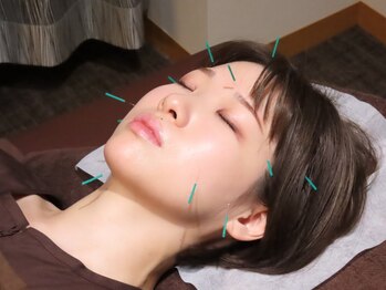 円山よもぎ鍼灸整骨院の写真/小顔・肌質改善◎2万人以上の施術実績！効果に自信◎《高品質・美容鍼ヘッドスパ+小顔マッサージ付￥3500》