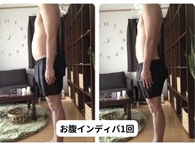 ランネル(Runnel)/インディバビフォーアフター