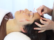 あろまはりきゅう 神楽坂の雰囲気（季節限定のメニューではお顔の鍼とマッサージもついています♪）