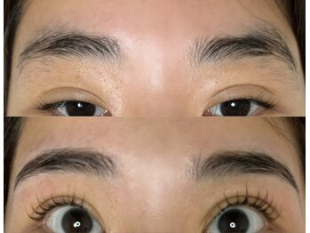 ノズ(NOZ)/まつ毛眉毛　Before/After