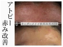 レイ(Rey)の雰囲気（敏感肌の方にも対応できるメニュー・技術が豊富な当店。）