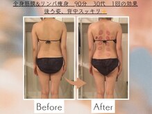 シェルシア(Cielcia)/筋膜リンパ痩身で後ろ姿スッキリ