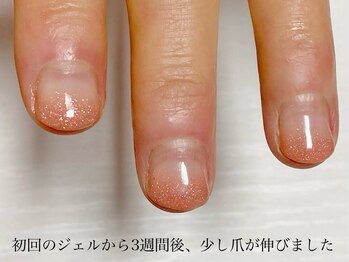 ウィッチ(witch)/難易度の高い深爪も3週間持つ!