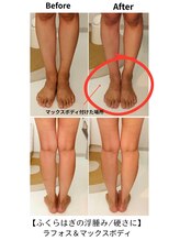 サロンドプレマージュ(Salon de Premage)/足裏～膝上マッサージ