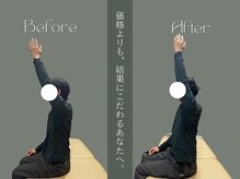 巡 金山店(MEGURI)/肩の痛み改善