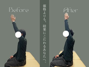 巡 金山店(MEGURI)/肩の痛み改善