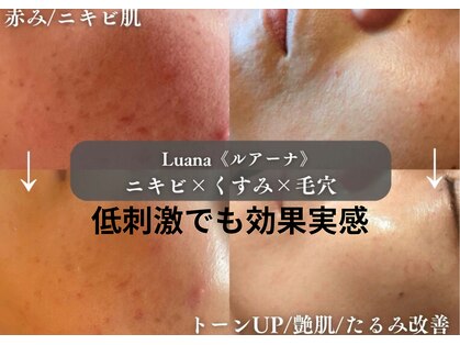 ルアーナ(Luana)の写真