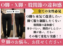 からだバランス整体 フロリス 梅田院の雰囲気（更年期/肩こり/腰痛/姿勢改善/頭痛/冷え性あらゆるお悩みも改善）