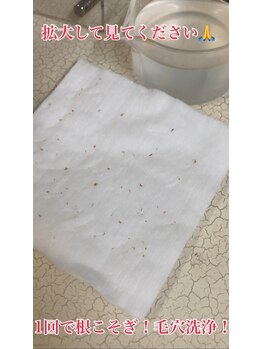 ビエル(Bielle)/1回で毛穴汚れをゴッソリ除去！