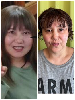 ヨサ パーク コアハート(YOSA PARK CORE HEART)/スッキリ美肌