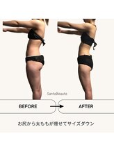 サンテボーテ(Sante Beaute)/ブライダル痩身