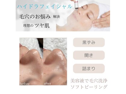 クリアビューティー(CLEAR BEAUTY)の写真