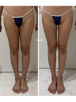 ピュウリリアーナ(Piu liliana)/40代のお客様☆