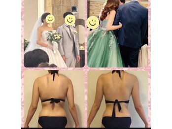 レナトゥス 銀座(Renatus)/挙式【痩身/東京/銀座】