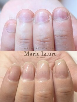 マリーロール 天王寺店(Marie Laure)/深爪矯正/自爪育成/ネイルケア