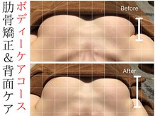 スナリ(SUNARI)の雰囲気（バストの大きさ、左右差改善、下垂、デコルテのハリUPに♪）
