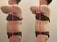 ヴィセラ(Vicella)の写真