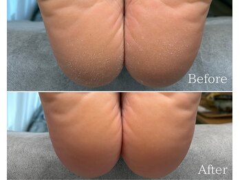 カシェット 広島店(Cachette)/40代女性☆足裏角質ケア90分