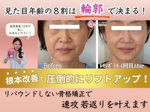 アンリエッタ(Unlieta)