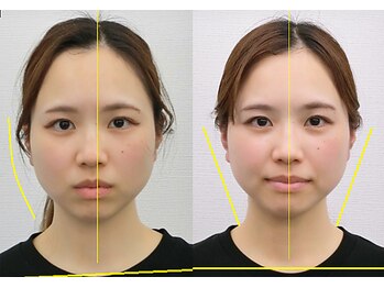 宮崎整体院/【美容整体】全身根本改善コース