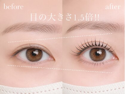 ラナン(Ranun)の写真