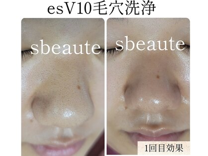 エスボーテ(sbeaute)の写真