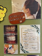 ルエマ(Lu ema)/ホワイトニング