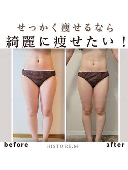 イストアールエム(HISTOIRE.M)/筋膜リリースダイエットコース