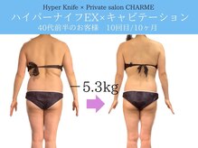 シャルム(charme)/ハイパーナイフEX痩身