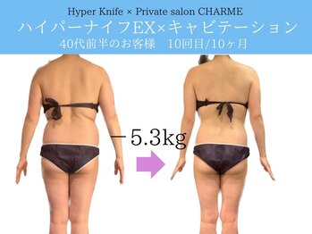 シャルム(charme)/ハイパーナイフEX痩身