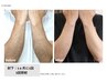 10歳～20歳まで　メンズ　腕まるごと脱毛￥9.000→￥7.000