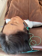 ハリファ鍼灸院 横浜関内院(HariFa鍼灸院)/美容施術/美容鍼