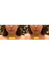 アジール 新潟市(agir)/Before/After画像