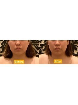 アジール 新潟市(agir)/Before/After画像