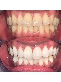 ライトビューティー 池袋店(LightBeauty)/症例写真