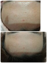 ソーハート(So Heart)/お肌のお悩み改善ならお任せ