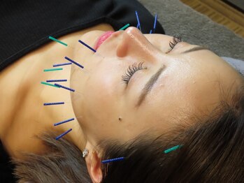 フローチ(FLOWQI)の写真/リフトアップ電気美容鍼◎フェイスライン/むくみ/食いしばり対策も◎体の中の流れも見ながら根本改善！