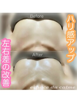 カルマーアンドビー(Calmer & Be.)/【バスト】Before/After