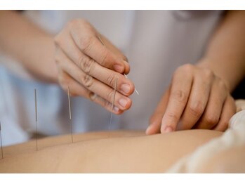 どんぐり鍼灸院 接骨院/ 【鍼灸施術】