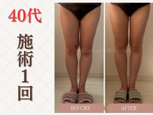 ミヨンビー(miyong.B)/