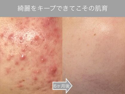 リリアス(RILLIAS)の写真