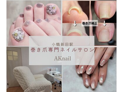 エーケーネイル(AKnail)の写真