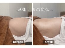 ドクターマジックタッチ(Dr.MAGIC TOUCH)/【腸活痩身】全出しデトックス